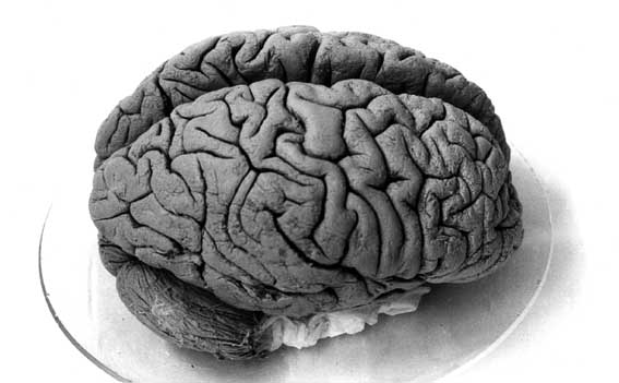 brain drain